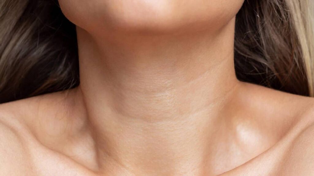 ρυτιδες λαιμου