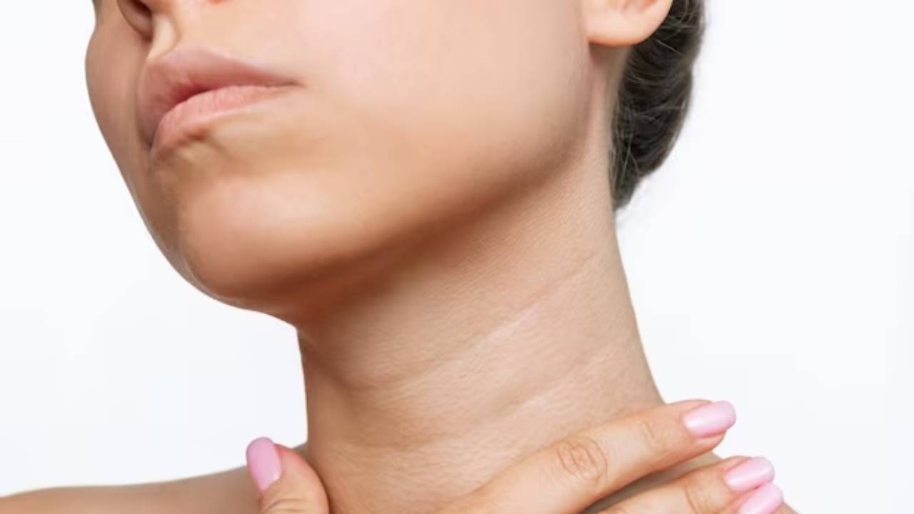 ρυτιδες στο λαιμο